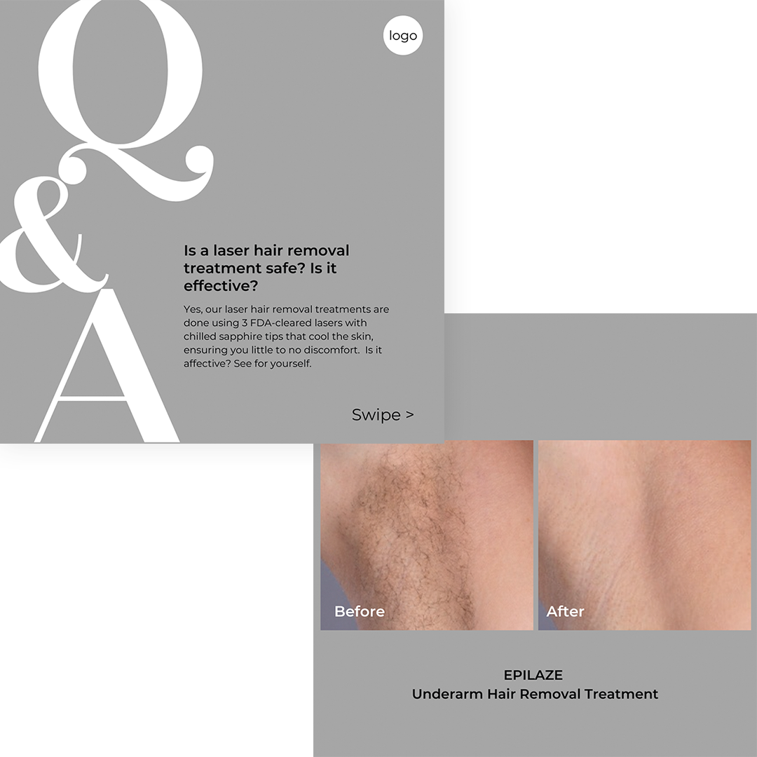 EpiLaze Carousel Image Template - Q&A Laser Hair Removal Safety & Effectiveness